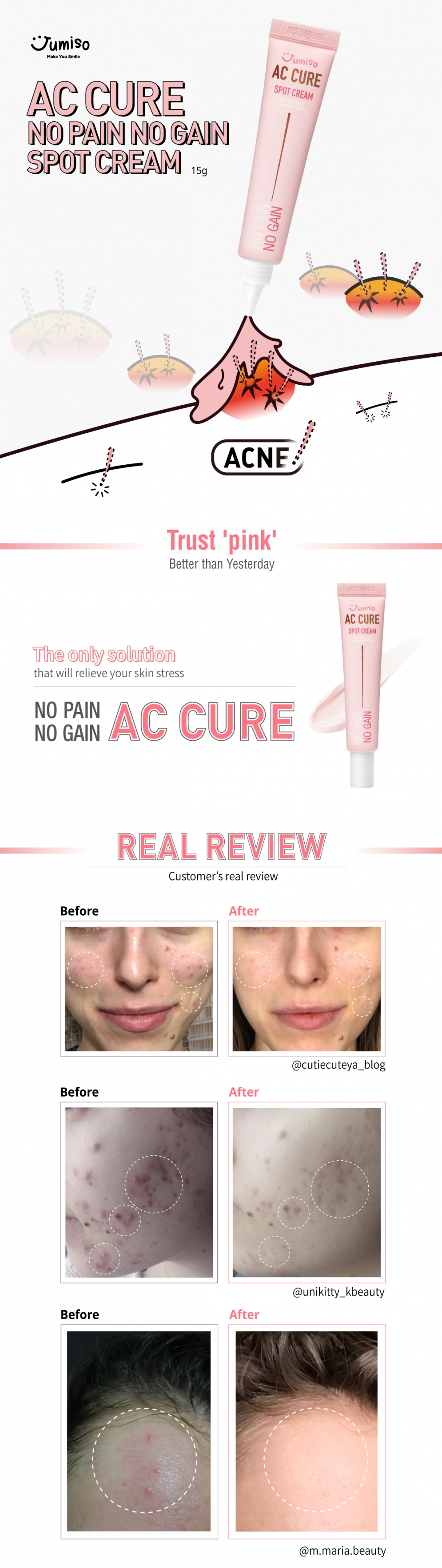 Image result for Jumiso AC Cure Spot Cream