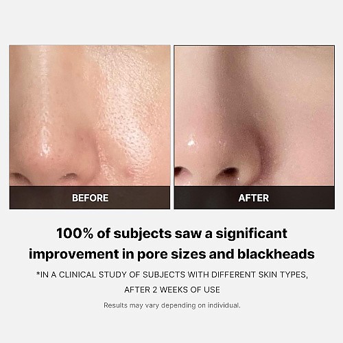 [MEDICUBE] Zero Pore Pad 2.0 (70ea)