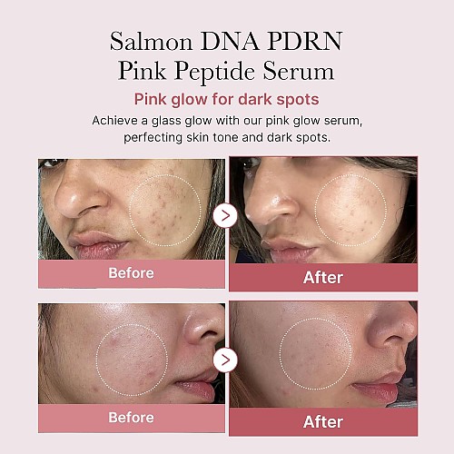 [MEDICUBE] Collagen PDRN Pink Peptide Serum 30ml