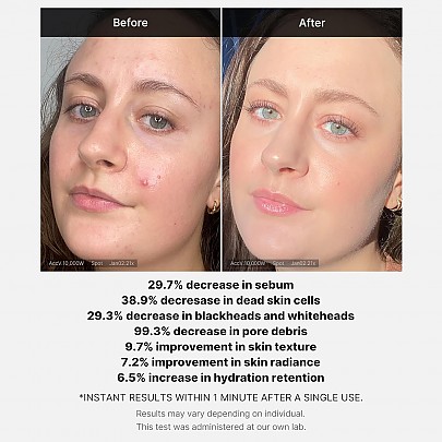 [MEDICUBE] Red Acne Succinic Acid Peel 40g