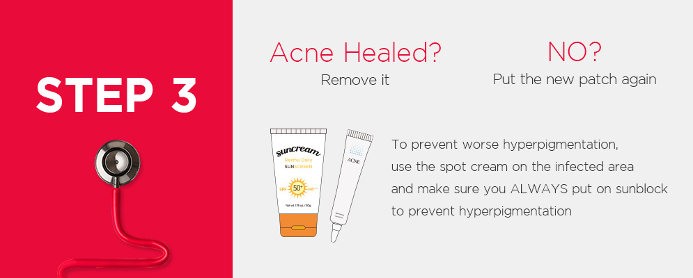 The Proper Steps to Calm Your Acne!